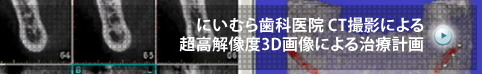 CT�ɂ�鎡�Ìv��