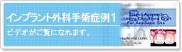 �C���v�����g�O�Ȏ�p�Ǘ�1