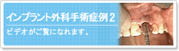�C���v�����g�O�Ȏ�p�Ǘ�2
