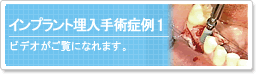 �C���v�����g������p�Ǘ�1