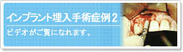 �C���v�����g������p�Ǘ�2