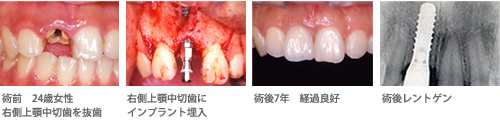 �C���v�����g�̖���