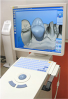 CAD-CAM