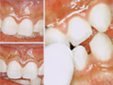 �F�f��������(�����j������)