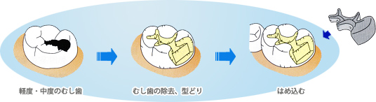 �͂߂鎡�Ö@