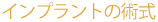 �C���v�����g�̏p��