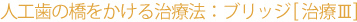 �l�H���̋��������鎡�Ö@�F�u���b�W[���ÂR]