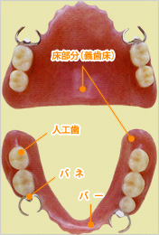 入れ歯の部位名