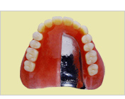 説明用義歯