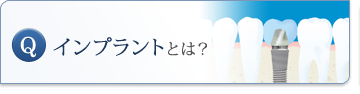 インプラント治療のよくある質問