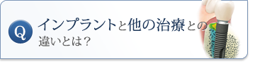 インプラントと他の治療との違いとは？