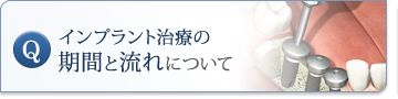 インプラント治療の期間と流れについて